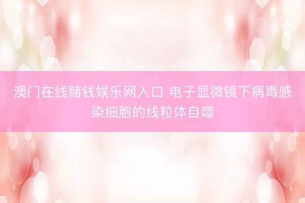 澳门在线赌钱娱乐网入口 电子显微镜下病毒感染细胞的线粒体自噬